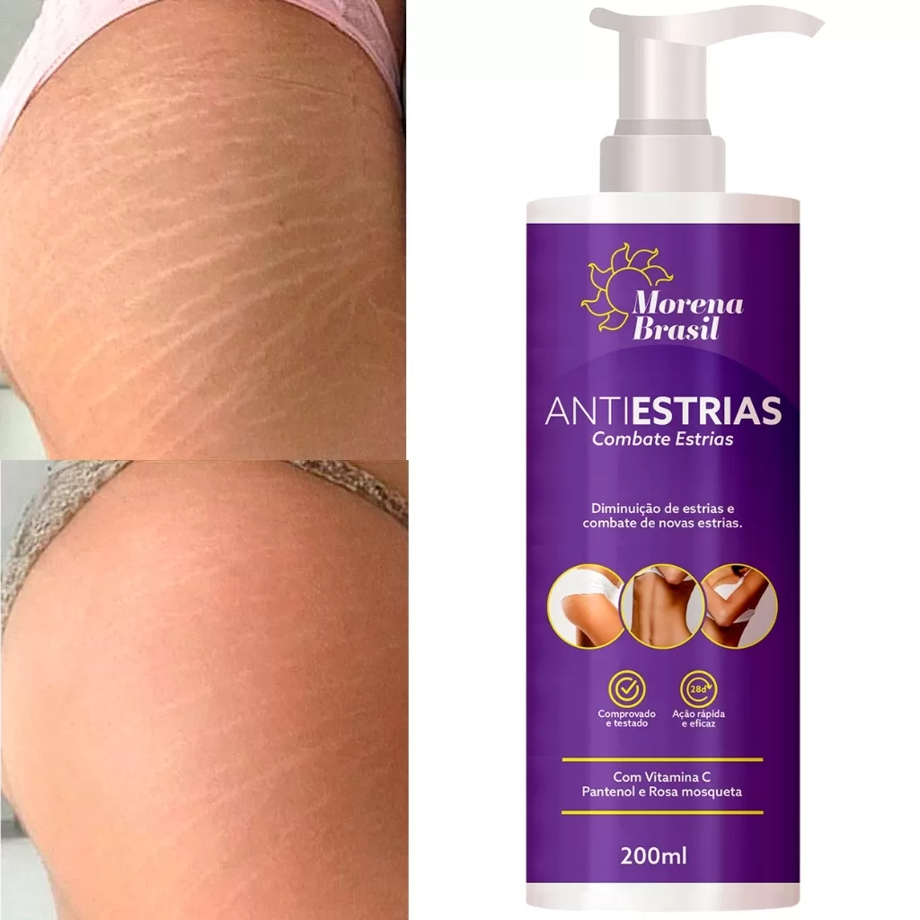 Creme Anti-Estrias Morena Brasil Ação Poderosa com Colágeno e Elastina