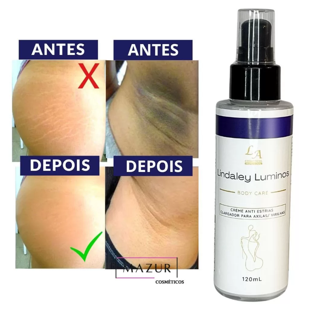 Lindaley Luminos – Anti Estrias – Clareador de Axila, Virilha, Joelhos 120ml – Entrega rápida