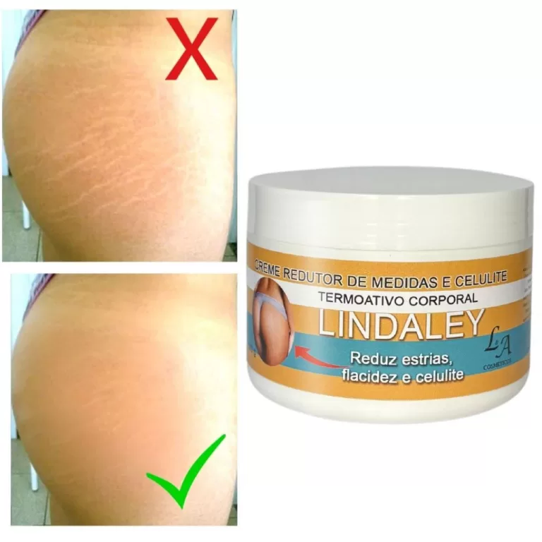 Creme Anti Estrias Removedor de Estrias 300g Linda