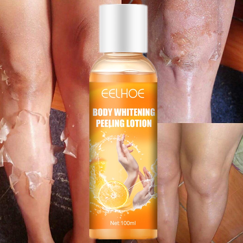 Gel Branqueador Imediato Descascador De Pele Máscara Fnger Joelho Axilas Manchas Escuras Creme Brilh