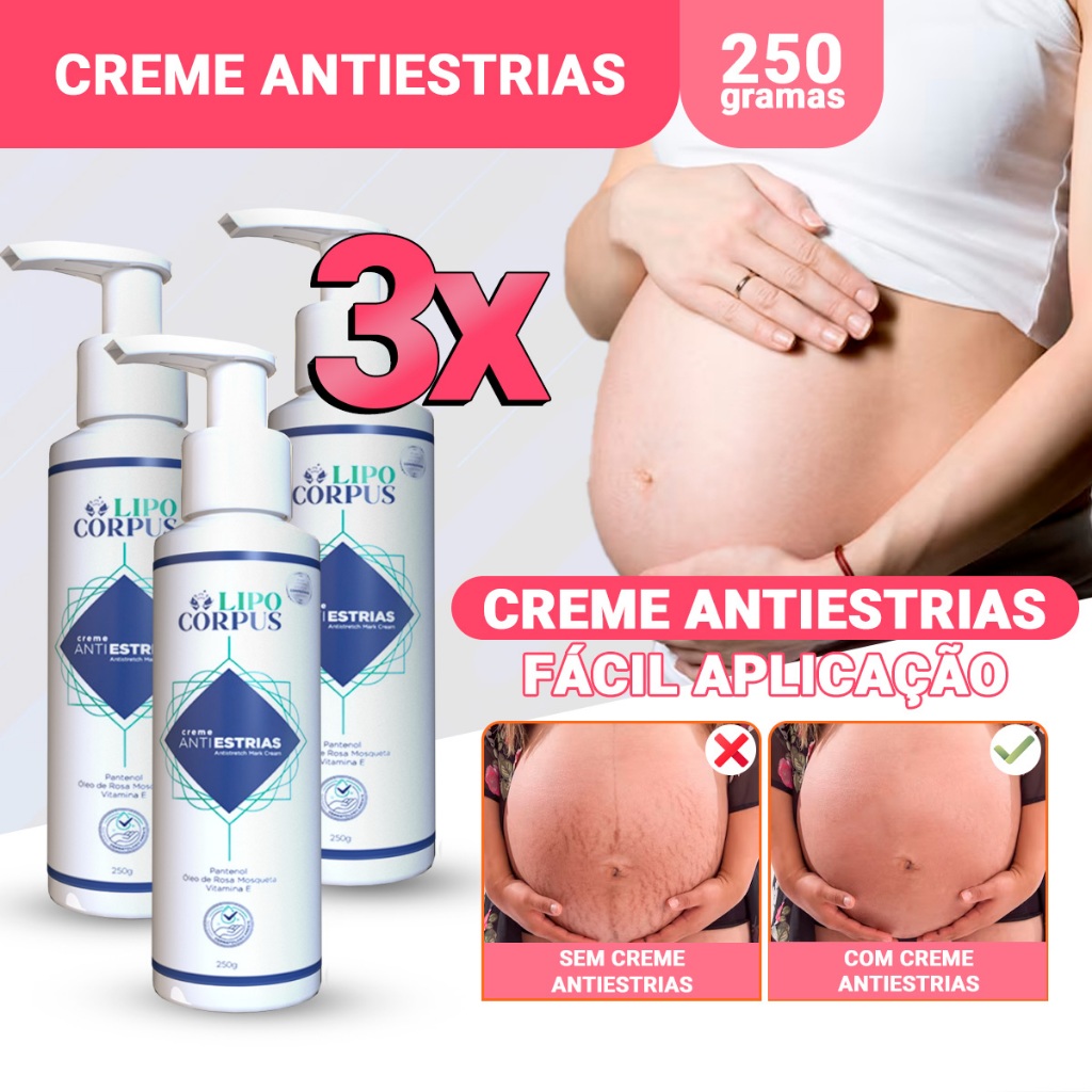 Creme AntiEstrias Removedor De Estrias Ação Poderosa | Qualidade Lipo Corpus – Original