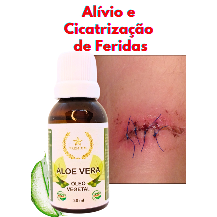 Óleo de Aloe Vera Babosa para Cicatrização Quei