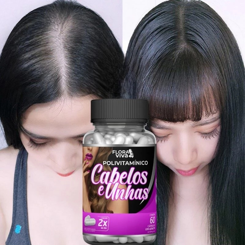 Polivitamínico para Cabelo e Unha – Fortaleça sua Beleza de Dentro para Fora