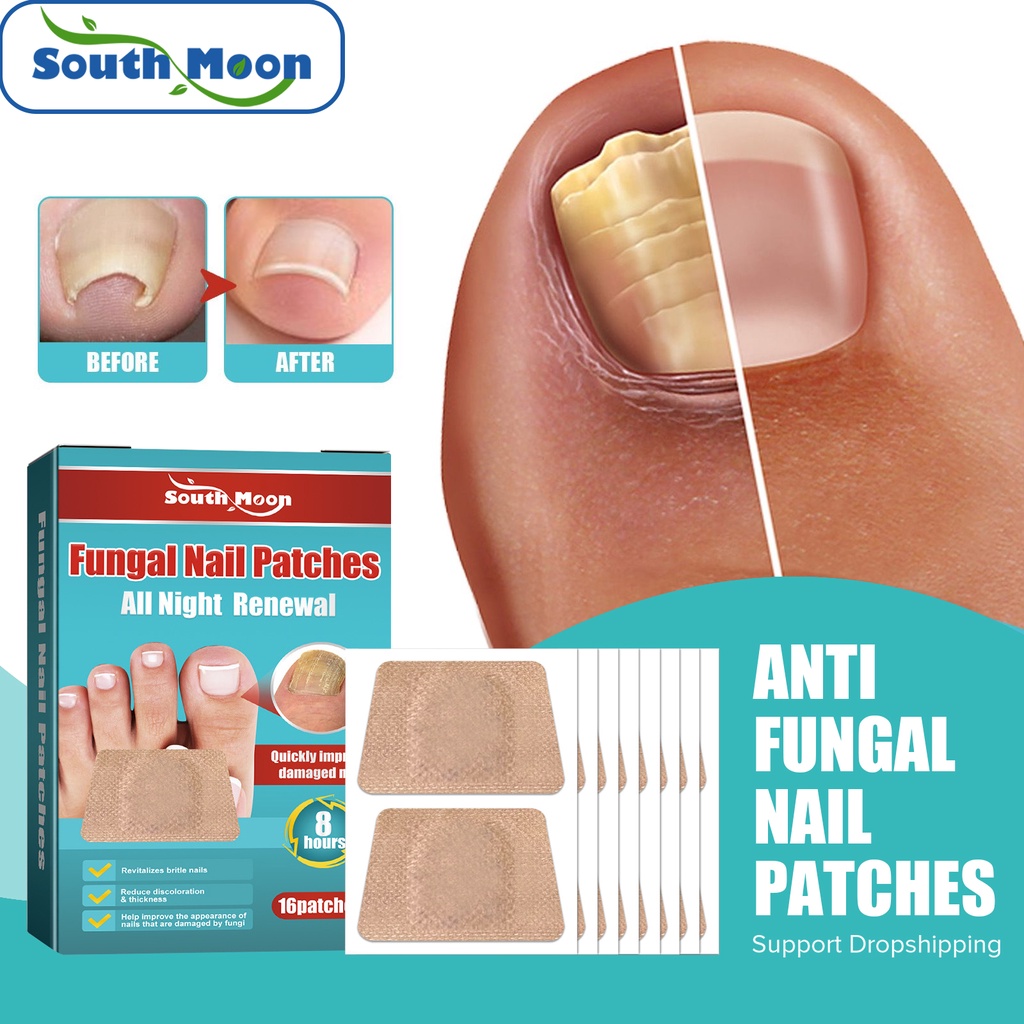 Patch De Tratamento De Unhas Lunares Do Sul Correção Anti-Fungos Adesivos Encravadas Paronychia Infe