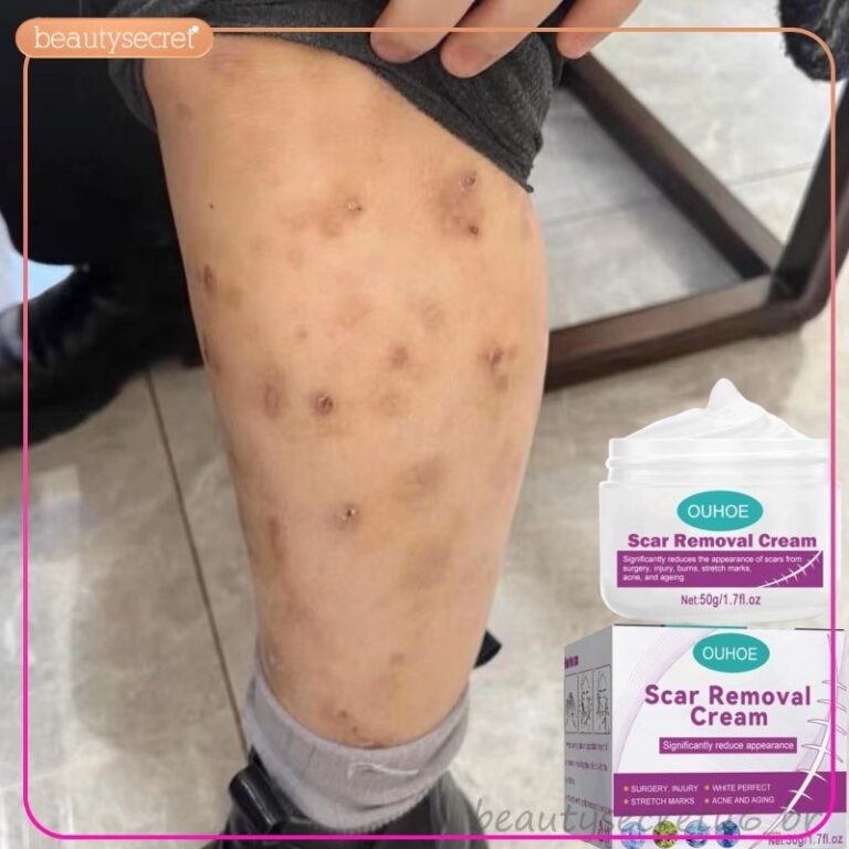 Creme Eliminar Cicatrizes Pretas Remover Feridas A
