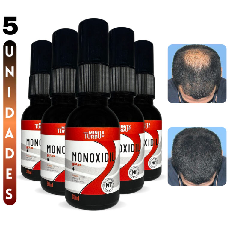 Tonico Original Na Caixa Crescimento Cabelo Envio 