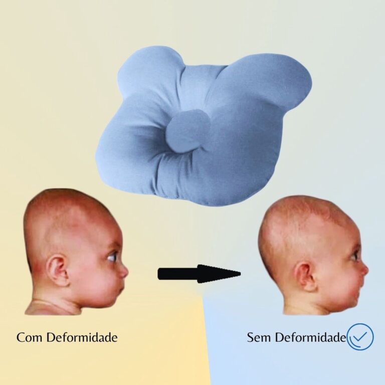 Travesseiro Plagiocefalia Cabeça Amassada Do Beb