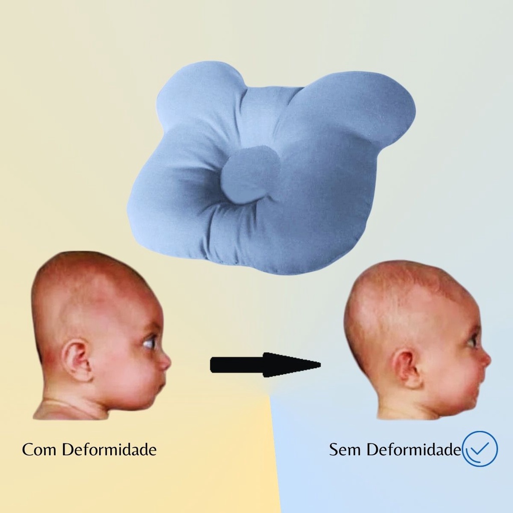 Travesseiro Plagiocefalia Cabeça Amassada Do Bebê