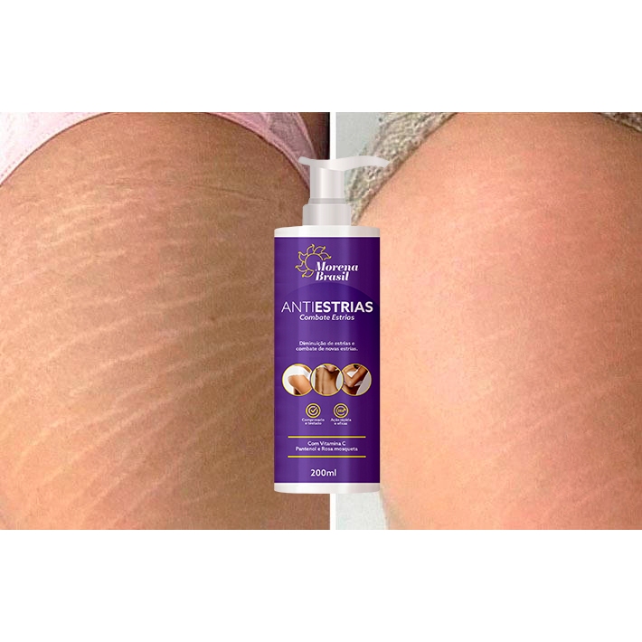 Creme Anti-Estrias Morena Brasil  Ação Poderosa 