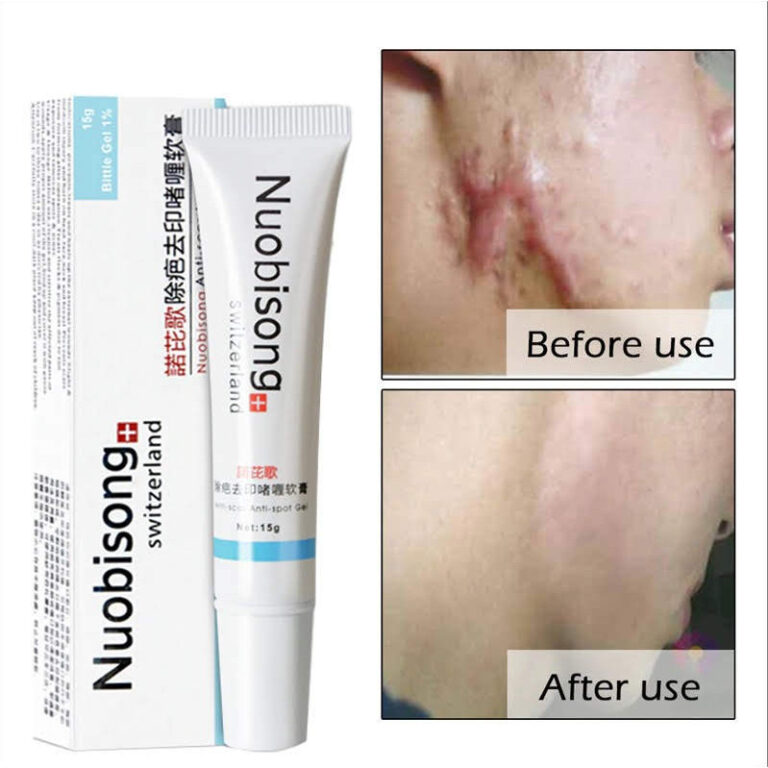 Gel Acne Queimaduras NACIONAL