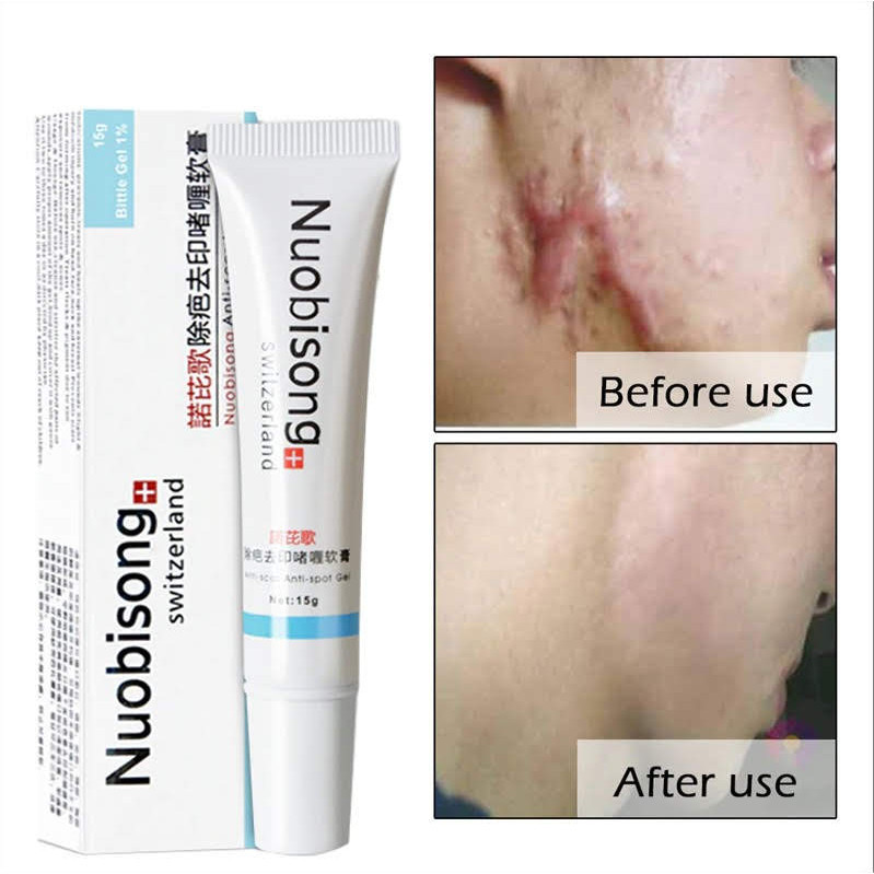 Gel Acne Queimaduras NACIONAL