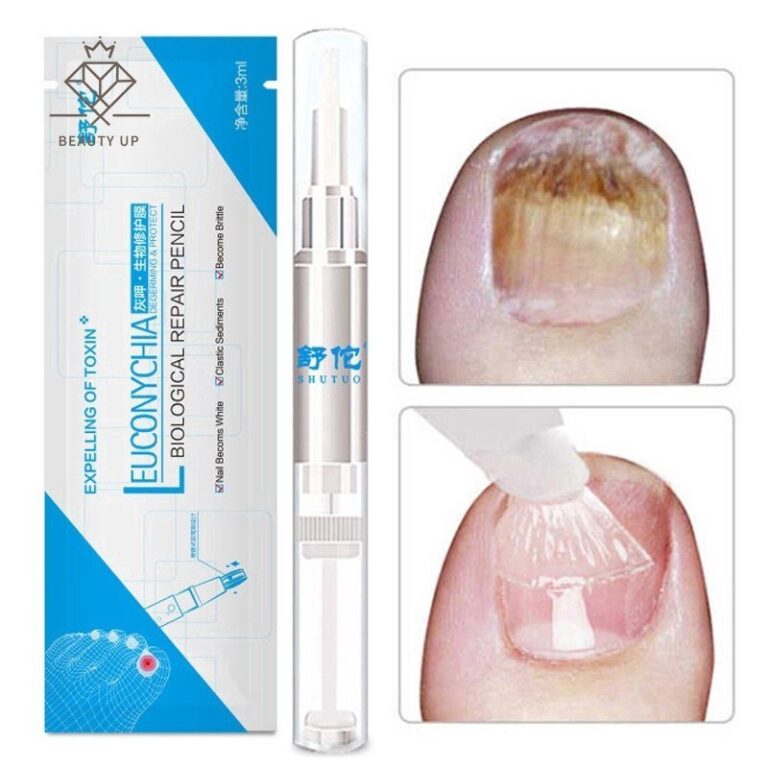 Prego Pen Onicomicose Paroníquia Infecção Herba