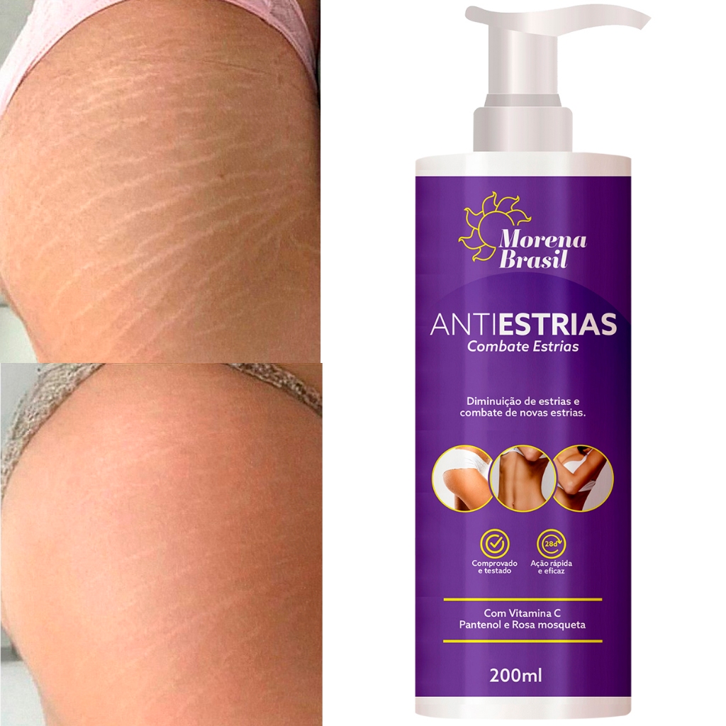 Creme Anti-Estrias Morena Brasil  Ação Poderosa com Colágeno e Elastina