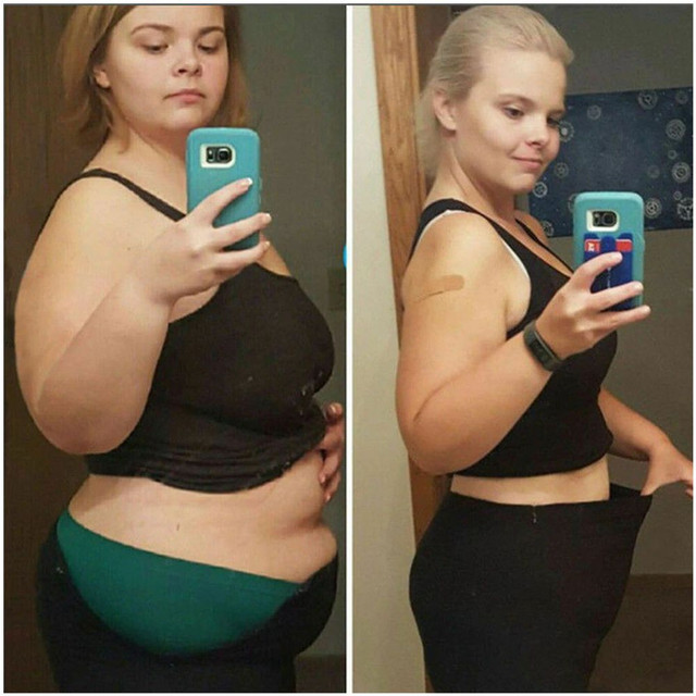 Cinta Abdominal Eletrica Modeladora Diminuir A Bar