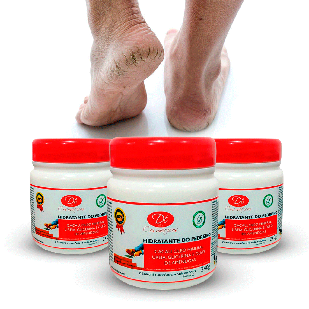 Creme Para Pedreiros 240g Diversos Tamanhos – Rachadura Nos Pés Ressecados Super Hidratante Corporal
