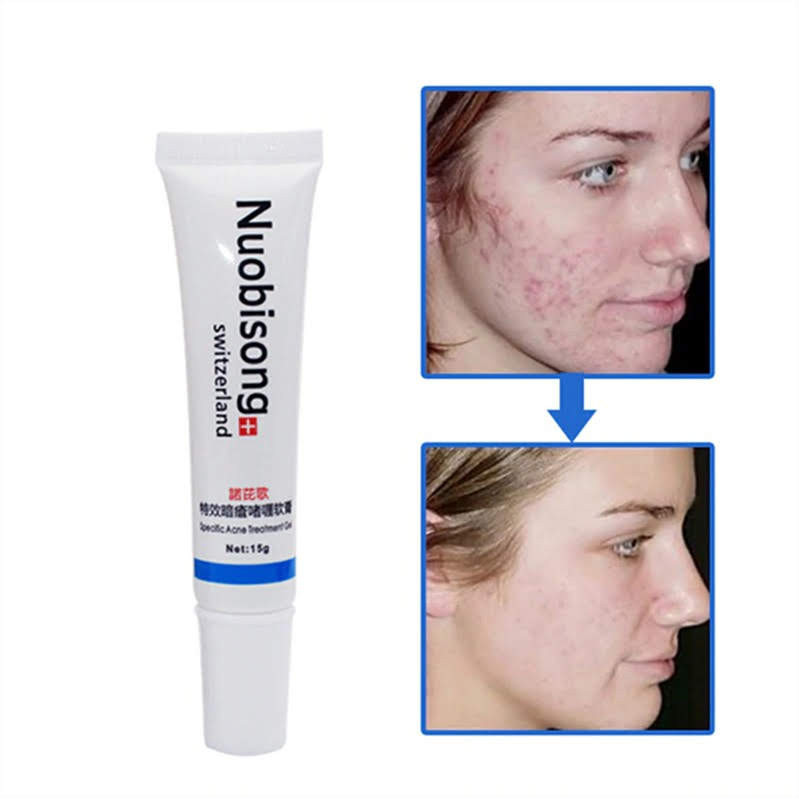 Gel Anti Acne Manchas Original