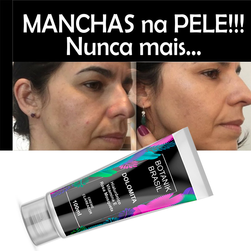 Creme Clareador Hidratante Axilas e Virilha Rosa Mosqueta/Dolomita/Para manchas na pele