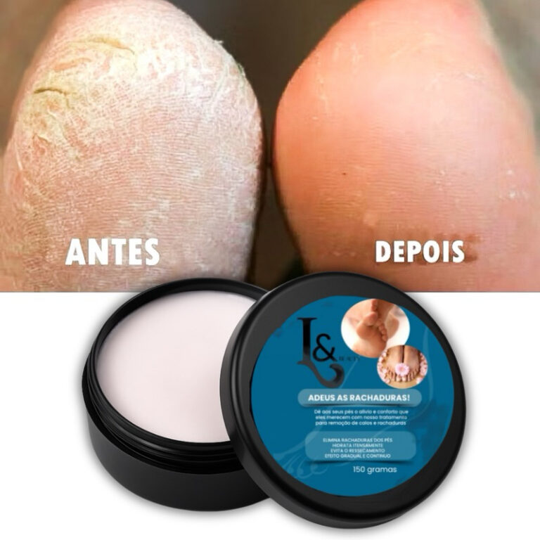 Creme Para Rachaduras Fissura Dos Pés Tratamento 
