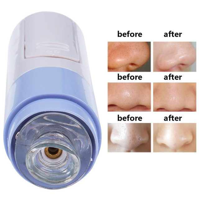 Extrator De Cravo A Vacuo Esteticista