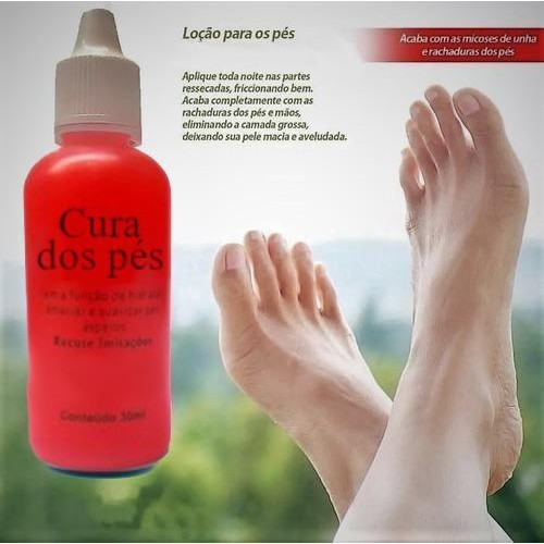 Deixar O Pes Ressecados E Descascando