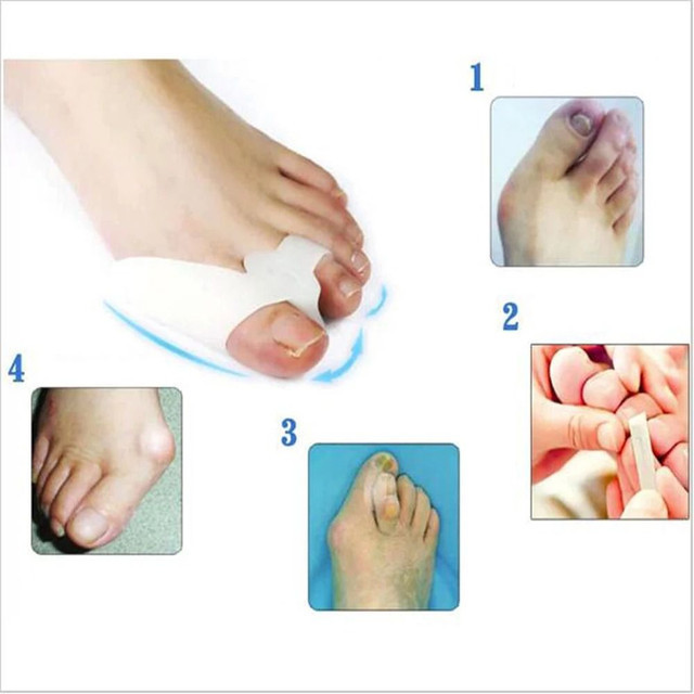 Silicone Para Joanete Silicone Par