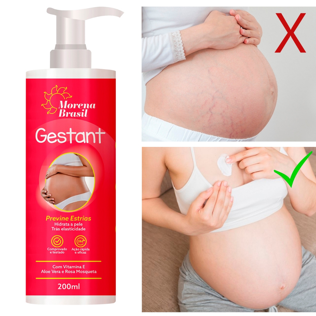 Creme Prevenção de Estrias na Gravidez: Cuidado Completo Pré e Pós-Gestação