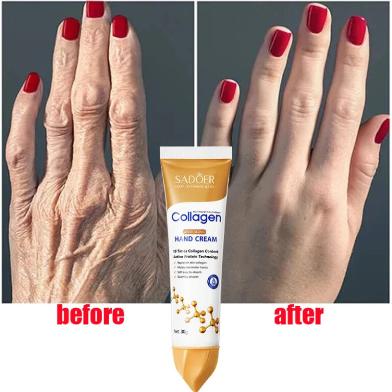Colágeno Creme Para As Mãos De Rachaduras Na Pel