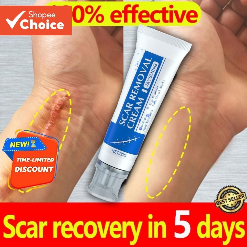 Advanced Scar 30g Creme Reparador Com Centella , Manteiga De Karité E Esqualano-Seguro Para Gravidez