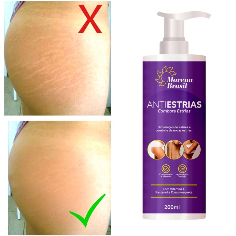 Creme Anti-Estrias Morena Brasil  Ação Poderosa 
