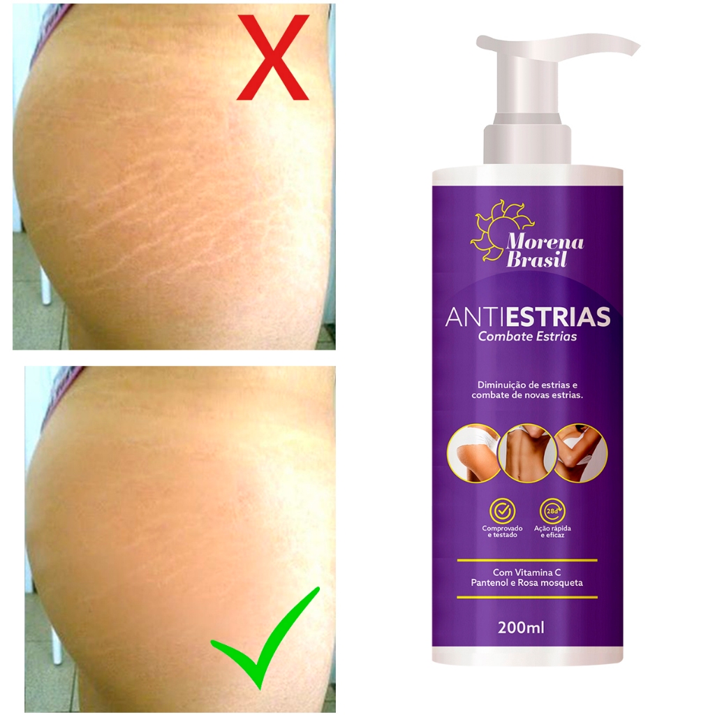 Creme Anti-Estrias Morena Brasil  Ação Poderosa com Colágeno e Elastina