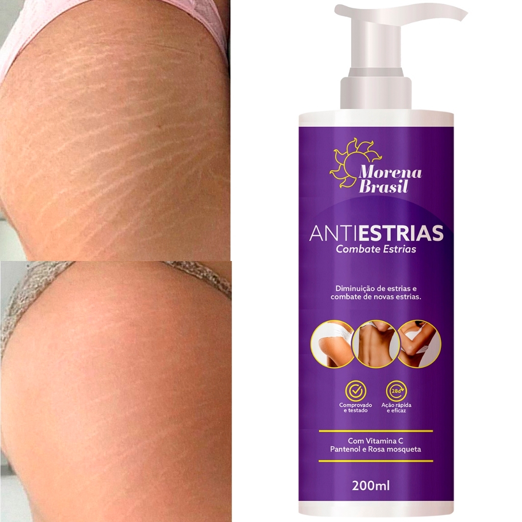 Creme Anti-Estrias Morena Brasil | Ação Poderosa com Colágeno e Elastina