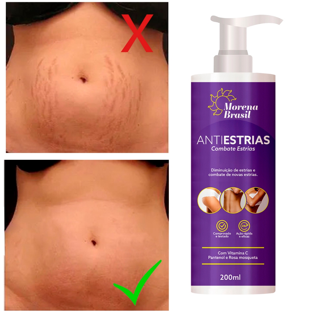Creme Anti-Estrias Morena Brasil – Ação Poderosa com Colágeno e Elastina