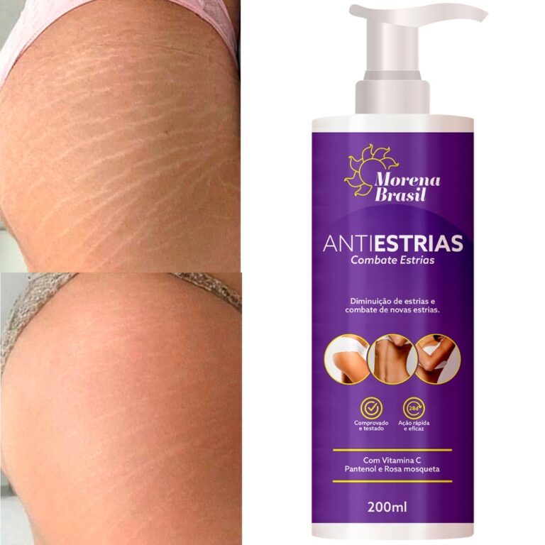 Creme Anti-Estrias Morena Brasil  Ação Poderosa 