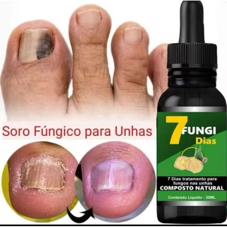 tratamento para micose melaleuca  fungos nas unhas