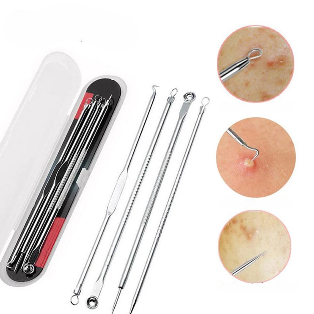 Kit estojo com 4 extratores para remoção de cravos e espinhas – material 100% aço