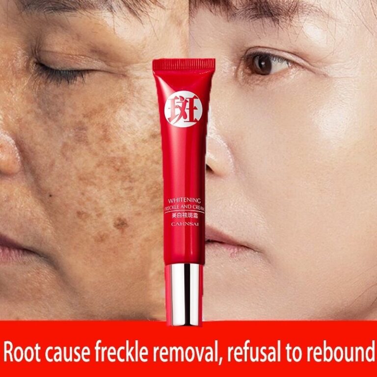 Creme forte original para remover manchas escuras/