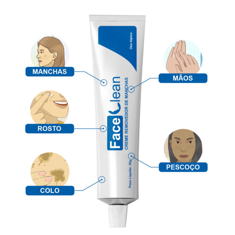 Melasma Branqueador Facial Limpo , Manchas E Acnes