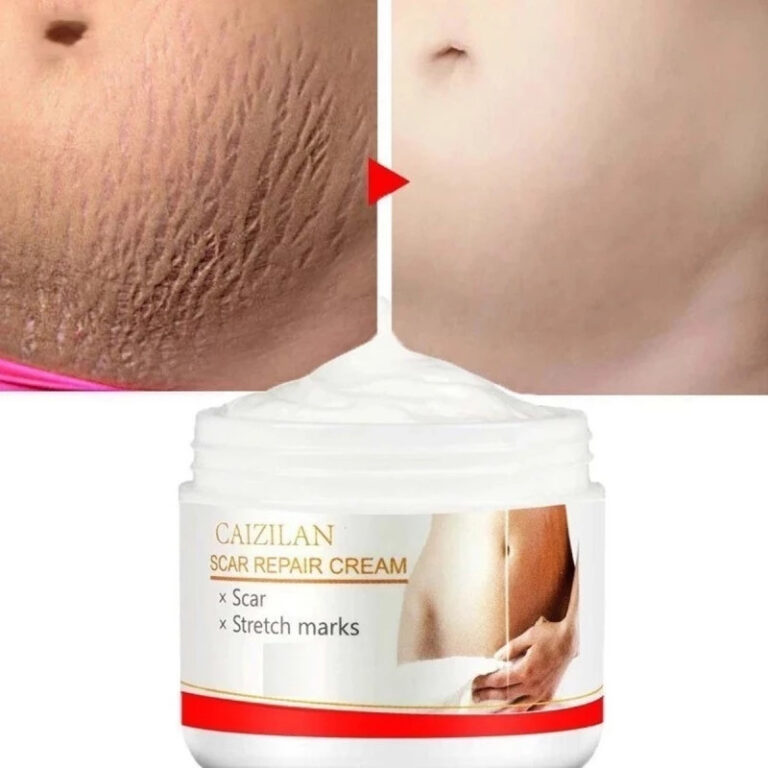 cicatricure estrias Creme Reparador De Cicatrizes 