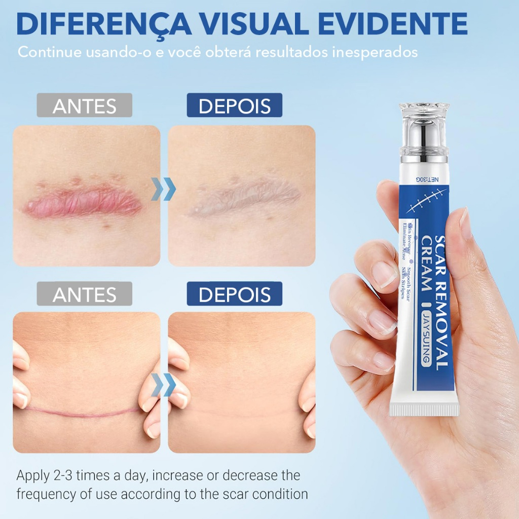 Fade Scar Repair Cream – Reduz e atenua cicatrizes de queimaduras e escaldões