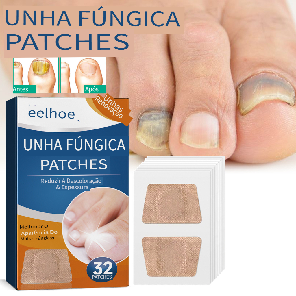 [Envio Rápido]Adesivo Antifúngico Invisível 2 em 1: Cobre e Cuida da Onicomicose