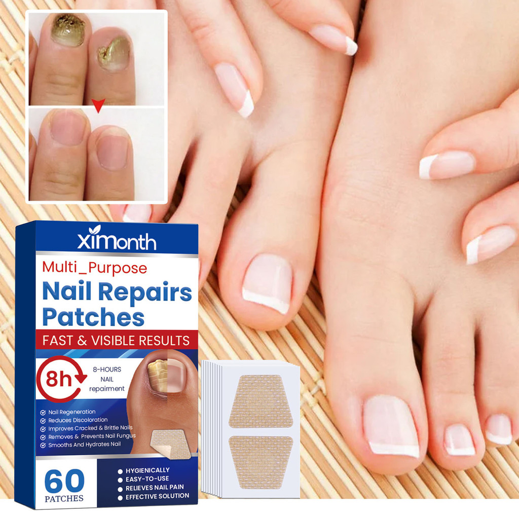 60 Pçs Adesivos De Tratamento De Fungos Nas Unhas Durante A Noite Reparação De Para Danos Solução De