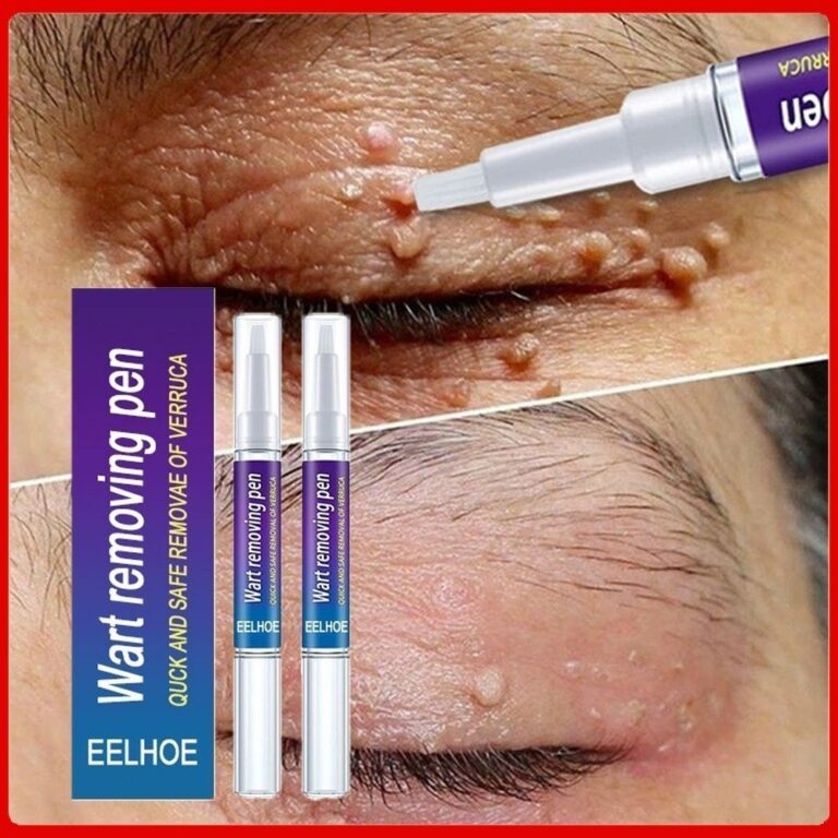 Novo Creme De Eliminação granular Para Reparaç