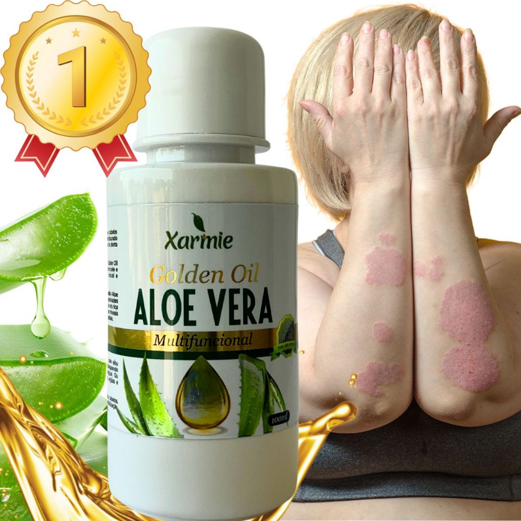 Auxilia Nos Cuidados com Psoríase Óleo de Babosa 100ml – , Hidrate e Proteja Sua Pele