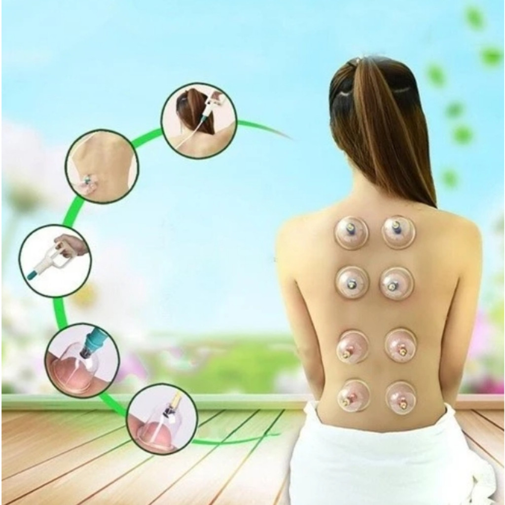 Kit com 12 Ventosas para Massagem: Ventosaterapia, Acupuntura e Massoterapia – Envio Imediato