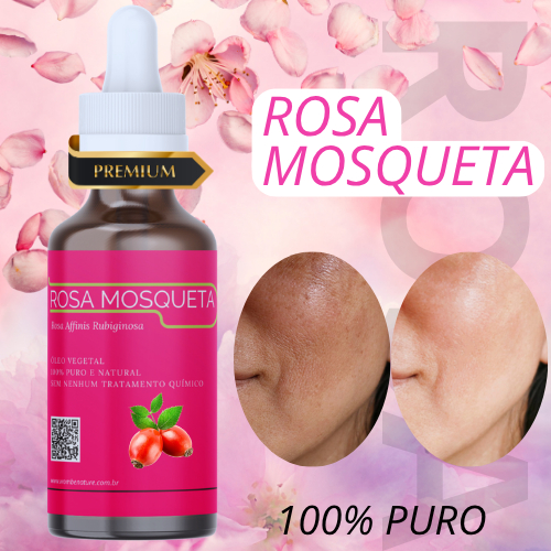 Óleo de Rosa Mosqueta – Clareador 100% Puro