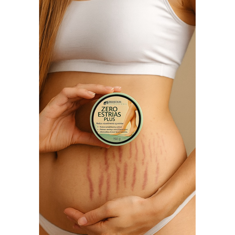 Creme Zero Estrias Plus Removedor Anti Estrias Trata E Previne 150g – RedFour