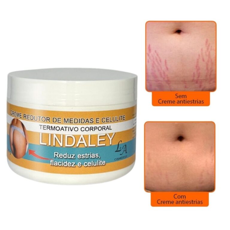 Creme AntiEstrias Removedor de Estrias 300g Lindal
