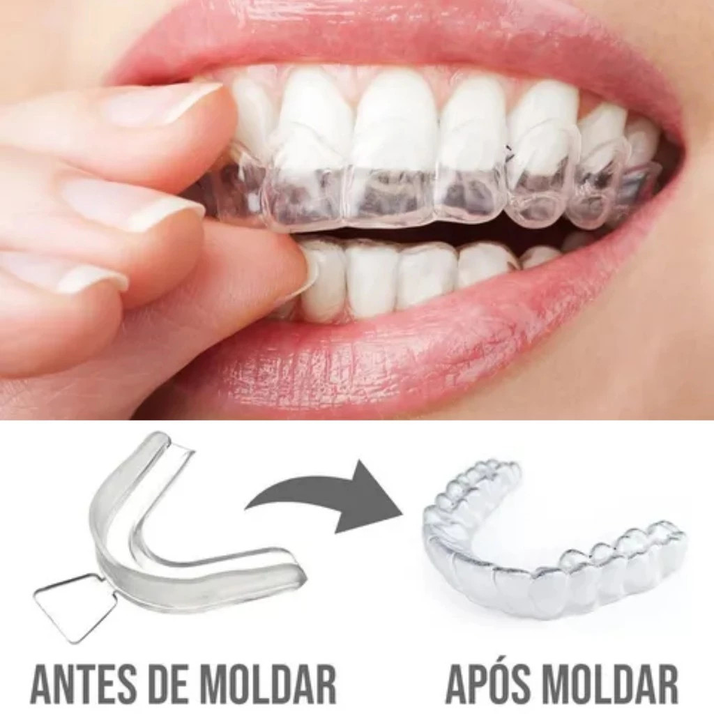 2 unidades (1 par) – Moldeira Molde Silicone Bruxismo Protetor Bucal…