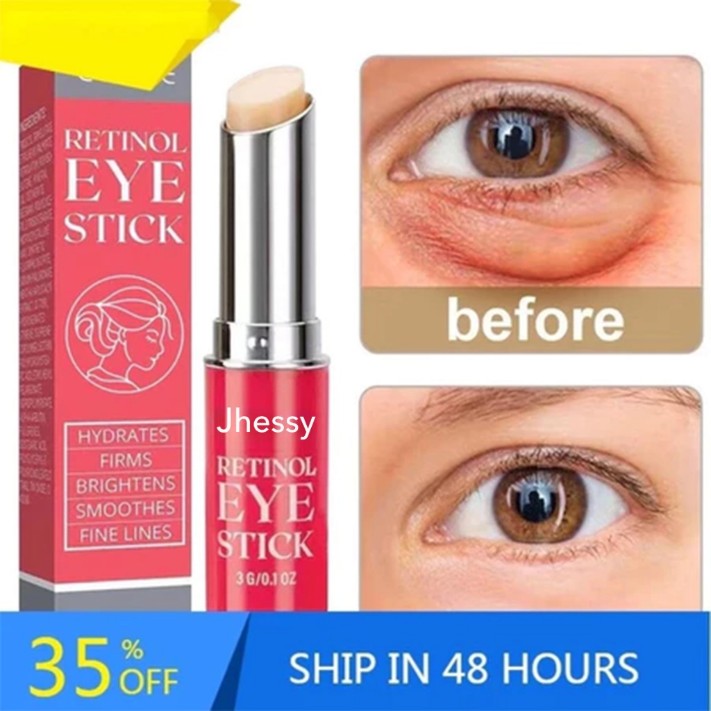 Creme para os olhos anti-rugas com retinol, remove bolsas nos olhos, olheiras, anti-envelhecimento,