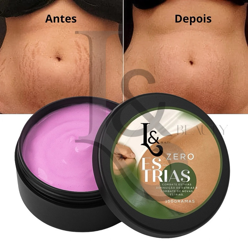 Creme Reduz Estrias Trata E Previne Estrias 150g – LEBeauty
